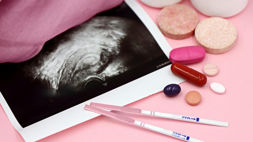 Pregnancy test with a positive result, ultrasound image, and prenatal vitamin supplements.
