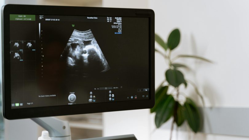 Ultrasound image displayed on a monitor in a medical clinic, with a plant and examination equipment in the background.